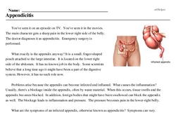 Print <i>Appendicitis</i> reading comprehension.