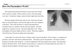 Print <i>How Do Pacemakers Work?</i> reading comprehension.
